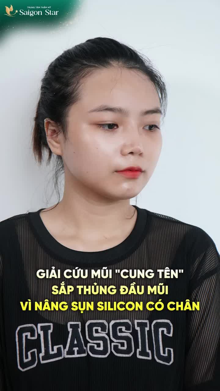 DR. HOẠT KỊP THỜI GIẢI CỨU MŨI HỎNG - NGĂN CHẶN TÌNH TRẠNG THỦNG ĐẦU MŨI!