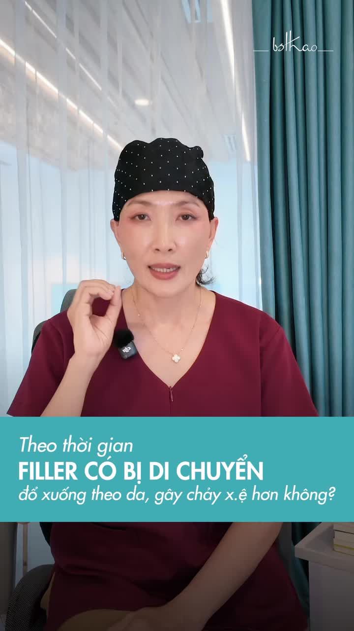 Tiêm Filler rồi theo thời gian Filler có bị di chuyển đổ xuống theo da gây chảy x.ệ hơn không?