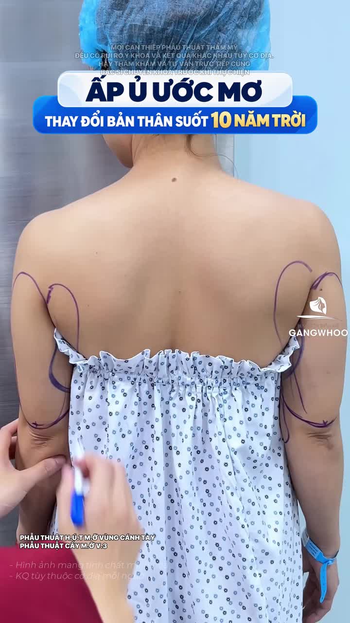Ấp ủ ước mơ suốt 10 năm cho đến khi gặp được BVTM Gangwhoo!!!
