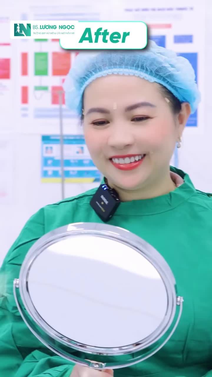 Bất ngờ với khả năng làm đầy hốc hác nhanh chóng của phương pháp cấy mỡ trẻ hóa
