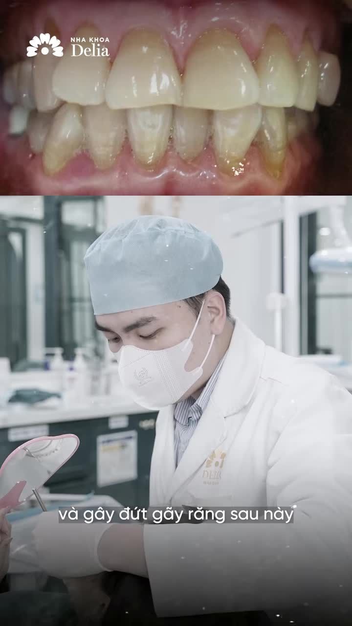 Răng Mòn Cổ, Ê Buốt khi ăn nóng/lạnh: Làm Răng Sứ có giải quyết được không?