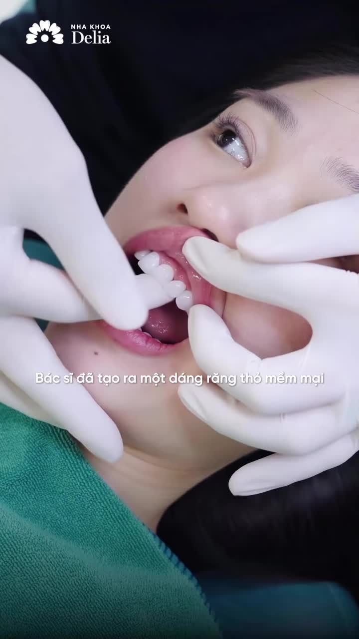 Từ trong nước ra quốc tế: Khách hàng nói gì về dáng răng tại Delia?