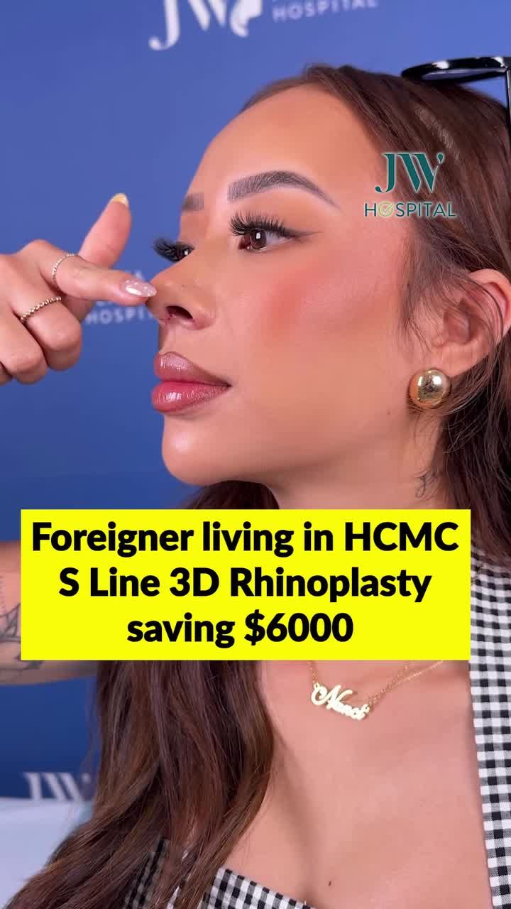 TIN VUI CHO NGƯỜI NƯỚC NGOÀI SỐNG TẠI TP.HCM - NÂNG MŨI S LINE 3D TẠI JW TIẾT KIỆM ĐẾN $6.000