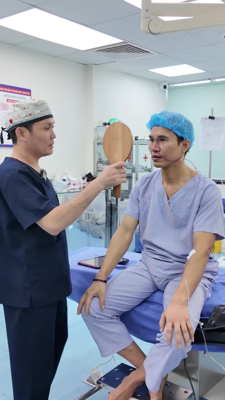 Kết quả trên cả kì vọng của case mũi lệch sau tai nạn, bàn tay vàng của Dr Vũ Quang đã lấy lại được dáng mũi, nụ cười sau 7 năm dài đằng đẵng sống chung với sự tự ti của KH giờ đây đã được xoá tan bằng diện mạo vô cùng phấn khởi và cực kì nam tính.