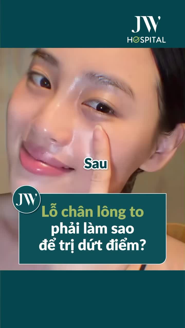 LÀM THẾ NÀO ĐΙỀU TRỊ DỨT ĐIỂM LỖ CHÂΝ LÔNG TO? XEM NGAY BÍ QUYẾT BÁC SĨ JW MÁCH CHO BẠN
