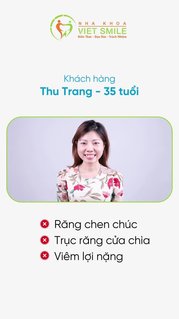 Niềng răng với Invisalign đã giúp khách hàng Viet Smile thay đổi như thế nào?