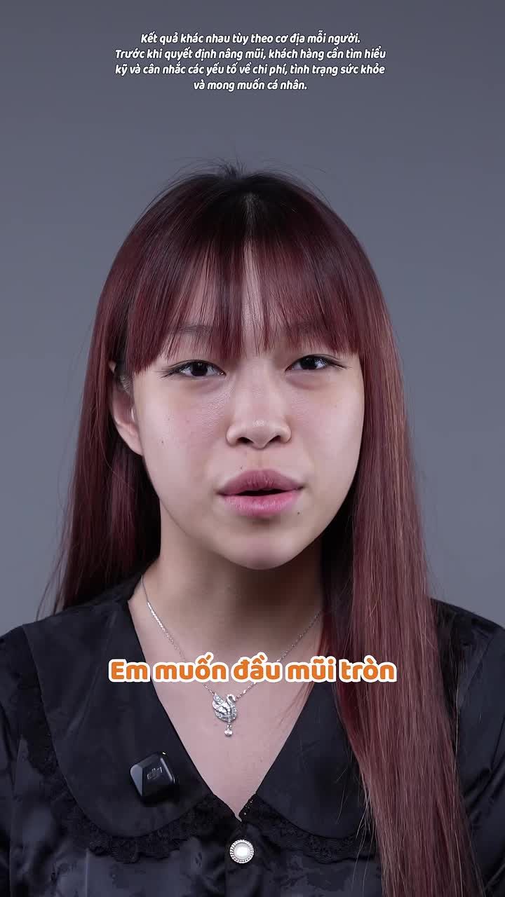 Từ Đài Loan về Việt Nam nâng mũi, vì sao khách hàng 2K8 tin chọn AZ NOSE?