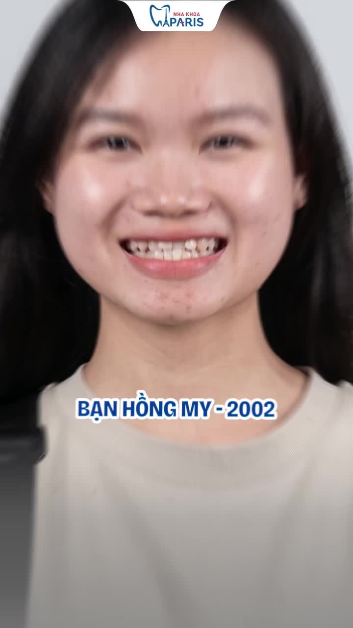 NHÌN TEAM GEN Z LỘT XÁC NỤ CƯỜI MỚI THẤY NIỀNG RĂNG DỈNH THẾ NÀO!