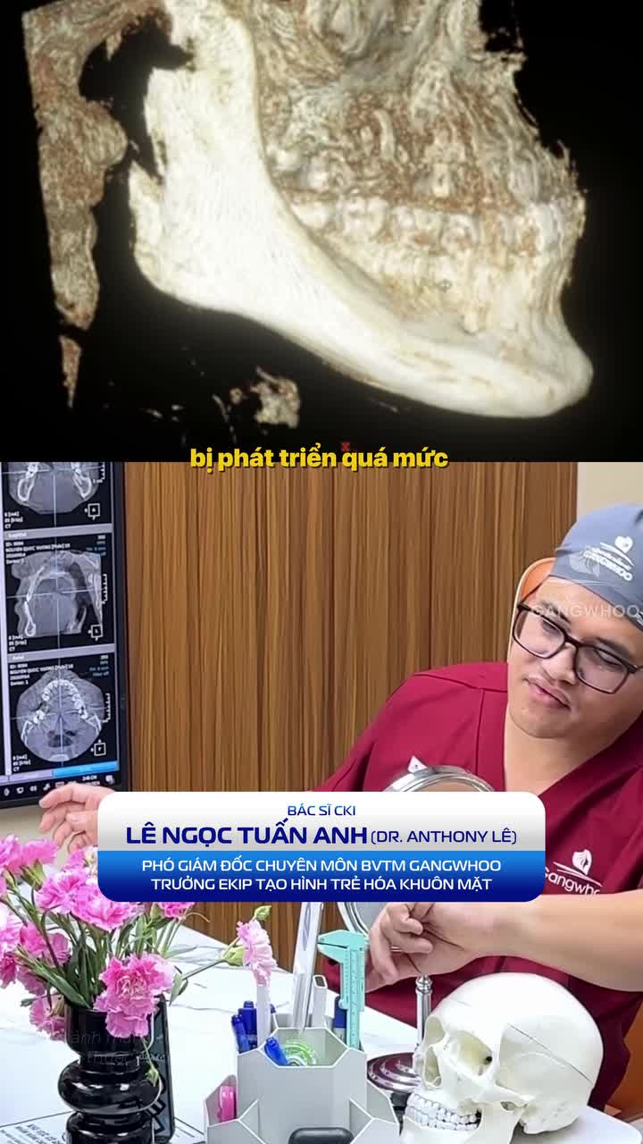 Xương hàm mất cân đối đến 2/3 gương mặt thì cần nên xử lý như thế nào để diện mạo cân đối hài hòa?