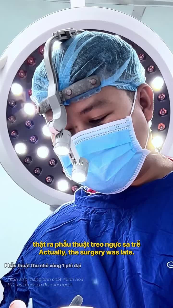 Vòng 1 phì đại không thu gọn chỉ treo sa trễ, liệu có đạt kết quả như mong muốn?