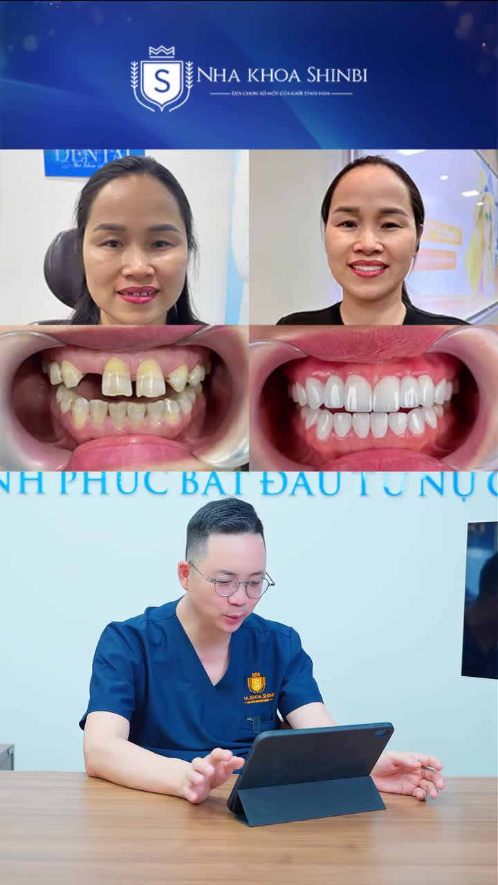 NỤ CƯỜI RẠNG NGỜI CỦA KHÁCH HÀNG SAU LÀM RĂNG SỨ — BÁC SĨ TẠI SHINBI CHẤM MẤY ĐIỂM?