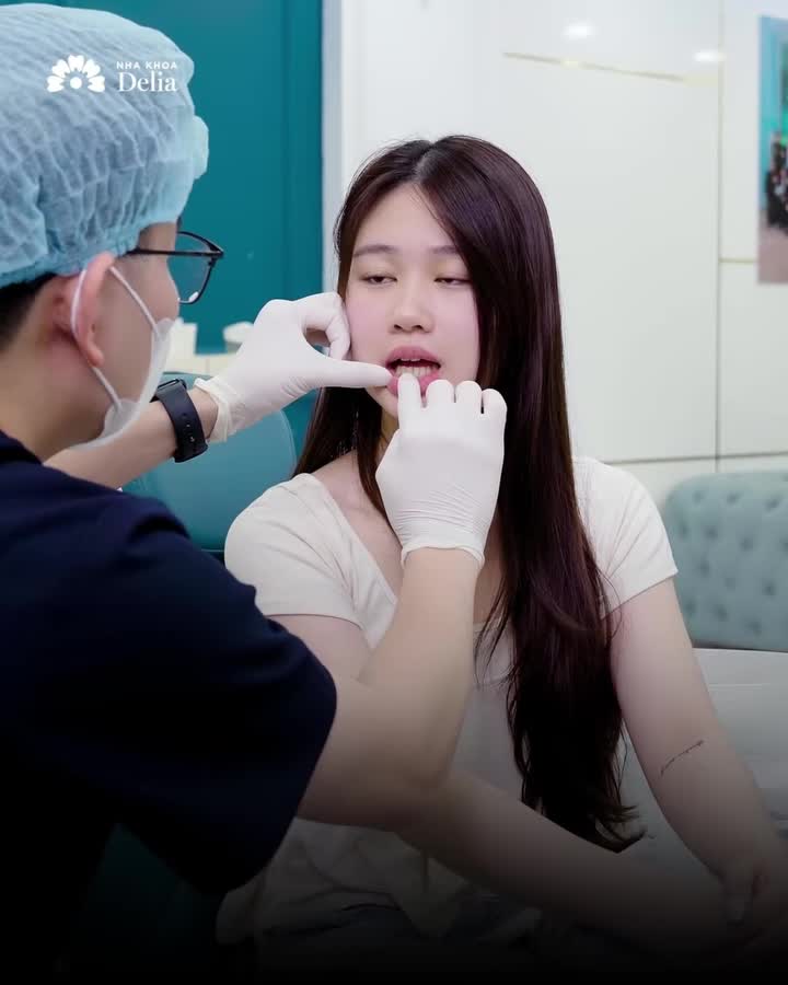 CÔ GIÁO GEN Z THĂNG HẠNG NHAN SẮC VỚI 19 RĂNG SỨ CERAMILL!
