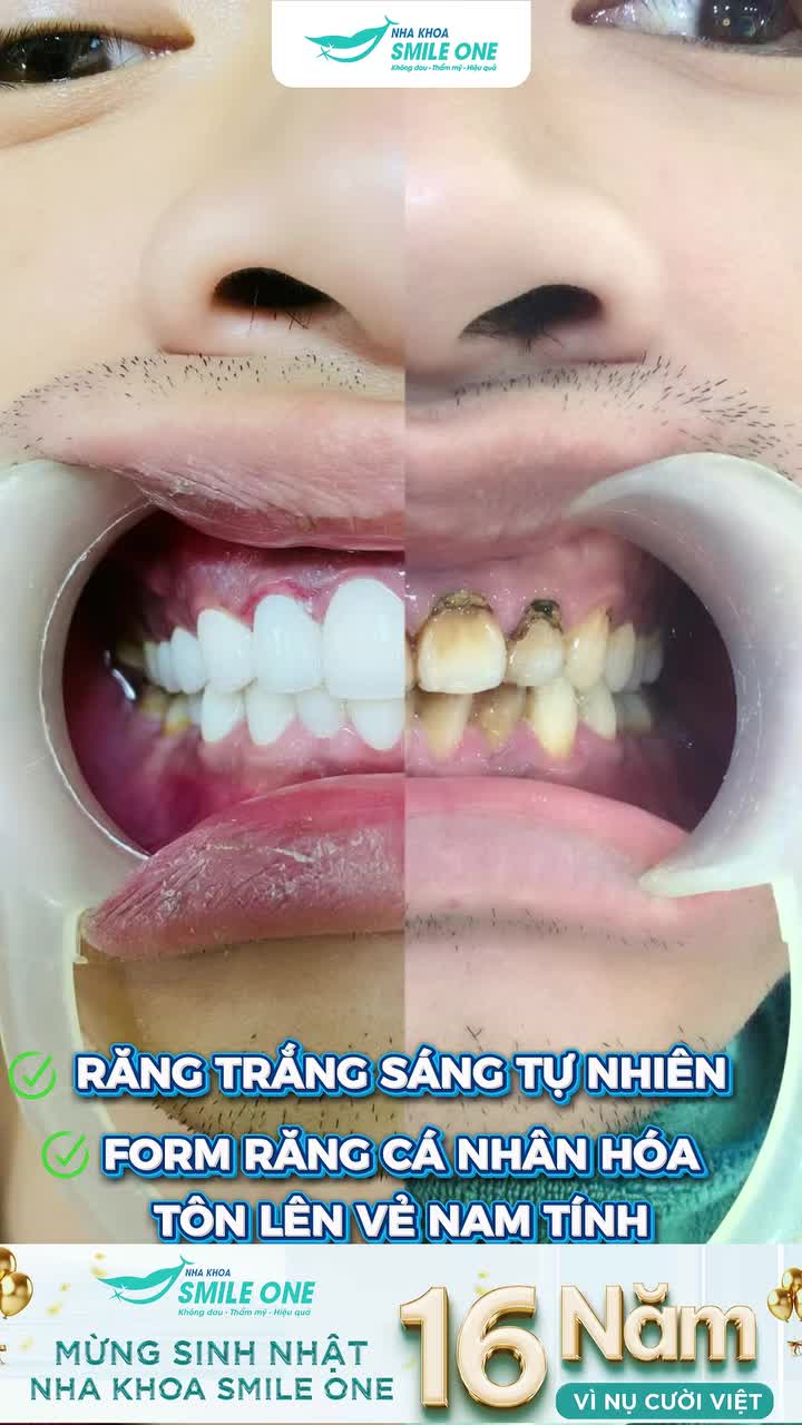 HẾT TỰ TI TÚT LẠI VẺ PHONG ĐỘ ĐÀN ÔNG
