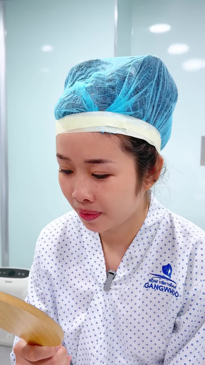 CẢM NHẬN KHÁCH HÀNG KHI THĂM KHÁM: VƯỢT QUA 5 NĂM ĐẮN ĐO ĐỂ TÌM LẠI DÁNG MŨI ƯƠNG MƠ!