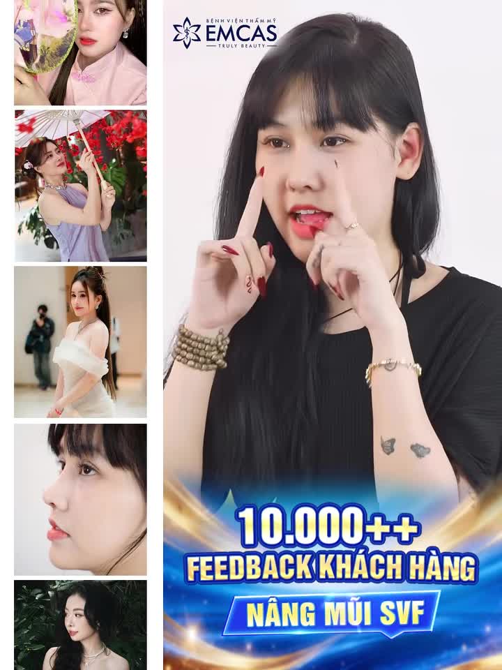SỞ HỮU DÁNG MŨI SVF THANH TÚ – TỰ TIN RẠNG RỠ CÙNG EMCAS