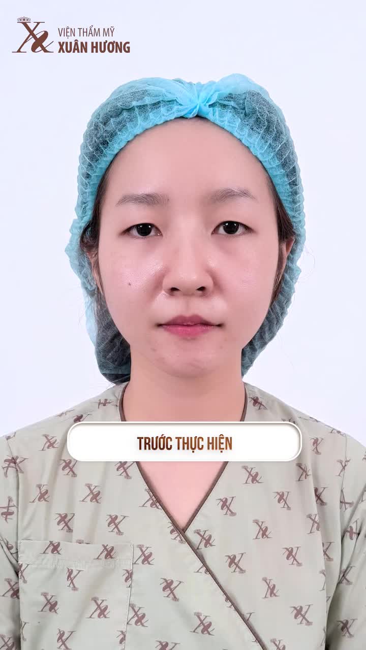 MỞ RỘNG ÁNH NHÌN – NÂNG TẦM THẦN THÁI