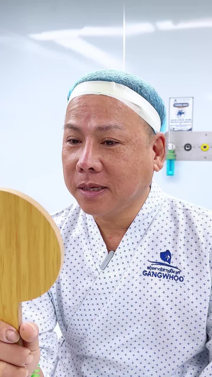 CẢM NHẬN KHÁCH HÀNG THĂM KHÁM: TÌM LẠI DÁNG MŨI TỰ NHIÊN SAU 3 LẦN PHẪU THUẬT KHÔNG NHƯ Ý!