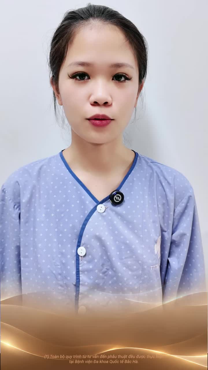 NÂNG MŨI KHÔNG CHỈ LÀM THAY ĐỔI DÁNG MŨI NHƯ BẠN NGHĨ