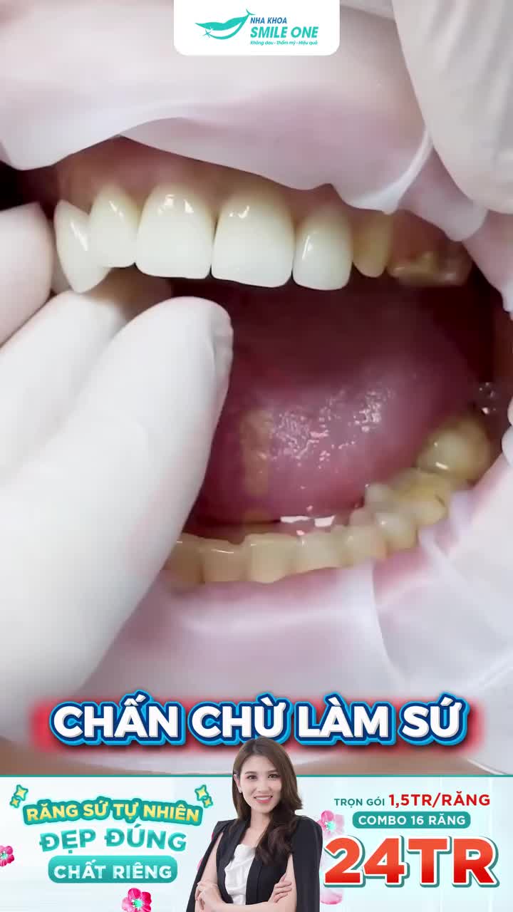 “Bố mẹ sinh ra đang yên lành… đừng có mài răng nhỏ xíu như cái đinh!”