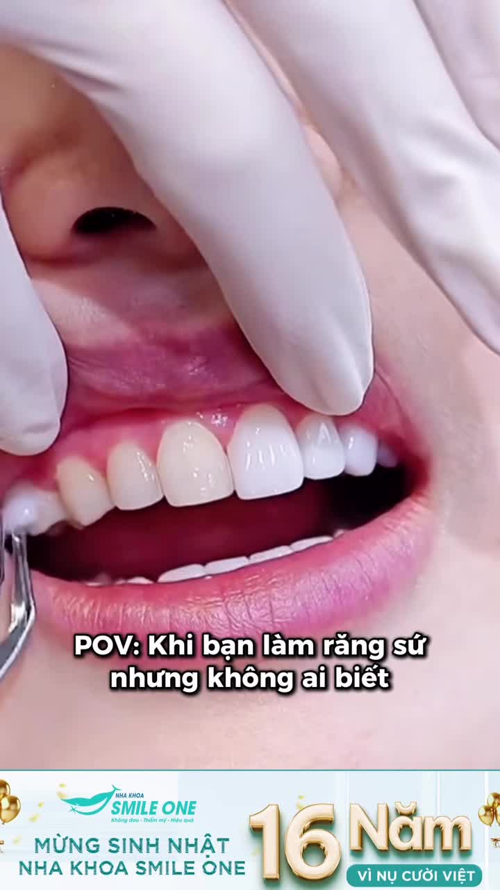 Không nói thì đố ai biết bạn làm răng sứ