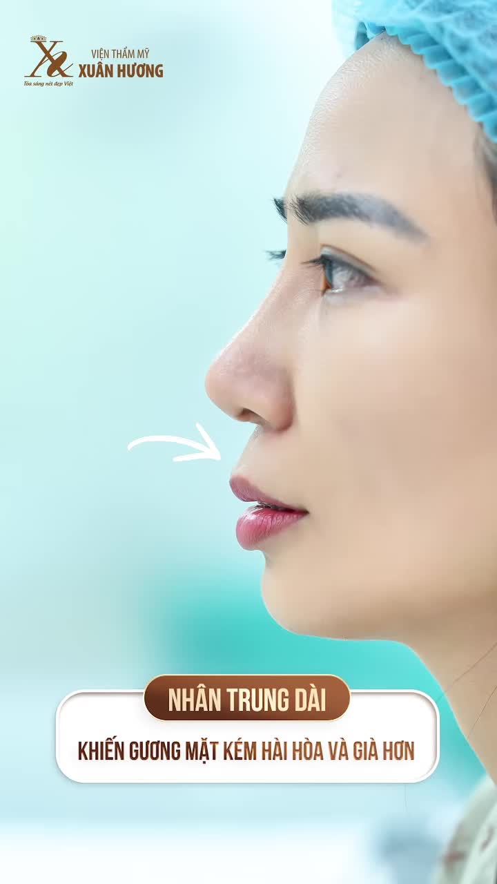 THU NGẮN NHÂN TRUNG – CÂN ĐỐI TỶ LỆ GƯƠNG MẶT