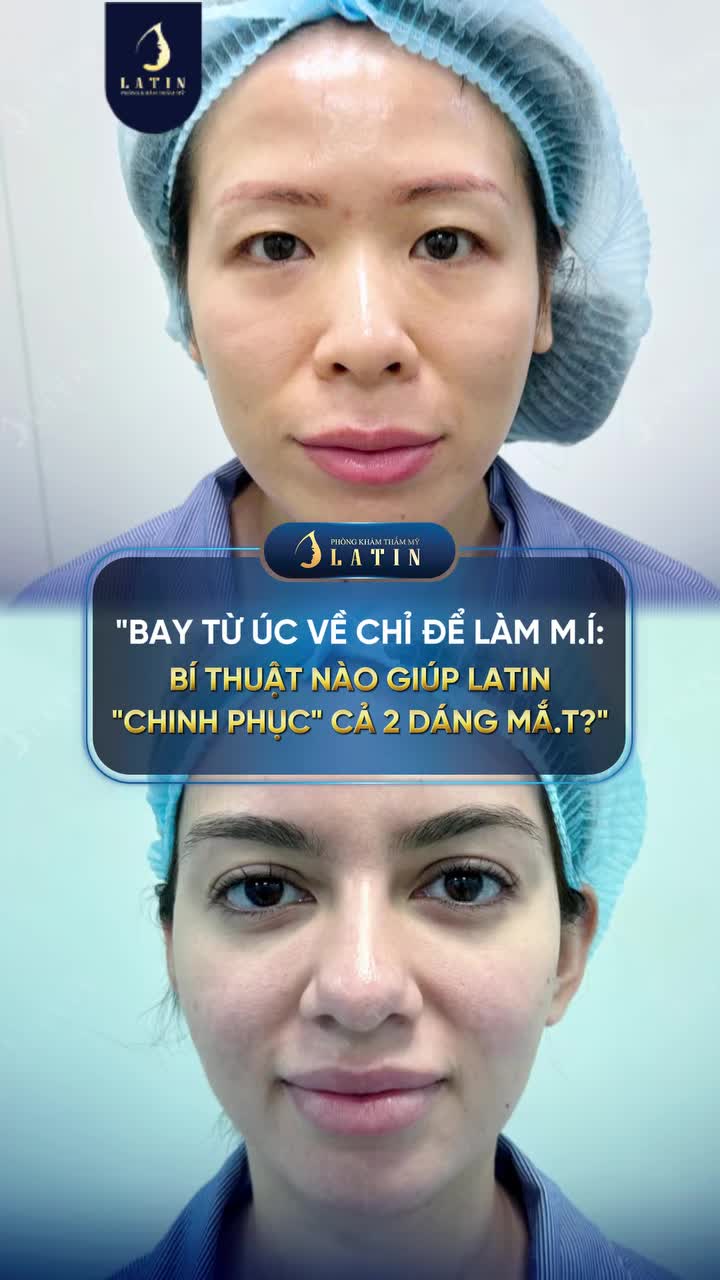 BAY TỪ ÚC VỀ CHỈ ĐỂ LÀM MÍ: BÍ THUẬT NÀO GIÚP LATIN "CHINH PHỤC" CẢ 2 DÁNG MẮT?