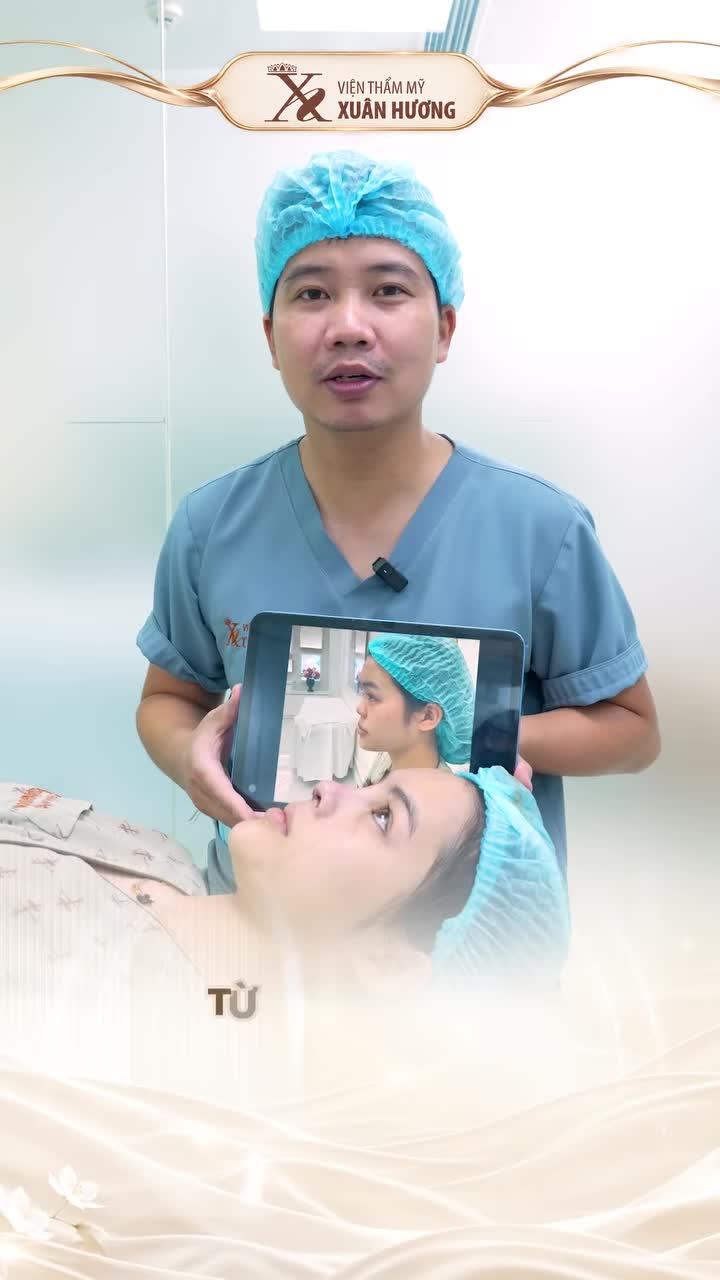 NÂNG MŨI CÓ ĐAU KHÔNG? BAO LÂU ĐỂ DÁNG MŨI ỔN ĐỊNH?