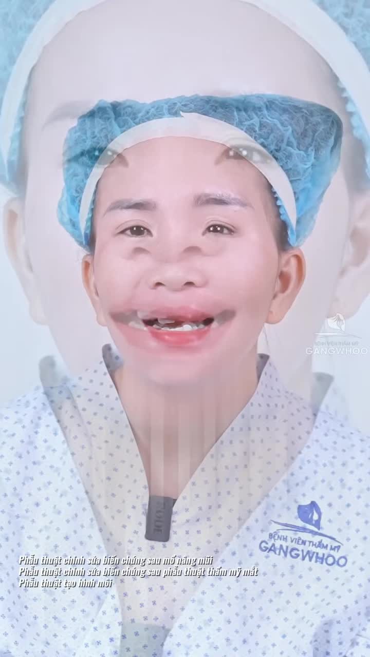 Gương mặt biến dạng vì tai nạn, liệu có thể lấy lại diện mạo hài hòa?