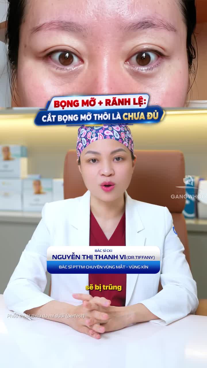 Bọng mỡ + rãnh lệ sâu: Cắt bọng mỡ thôi là chưa đủ