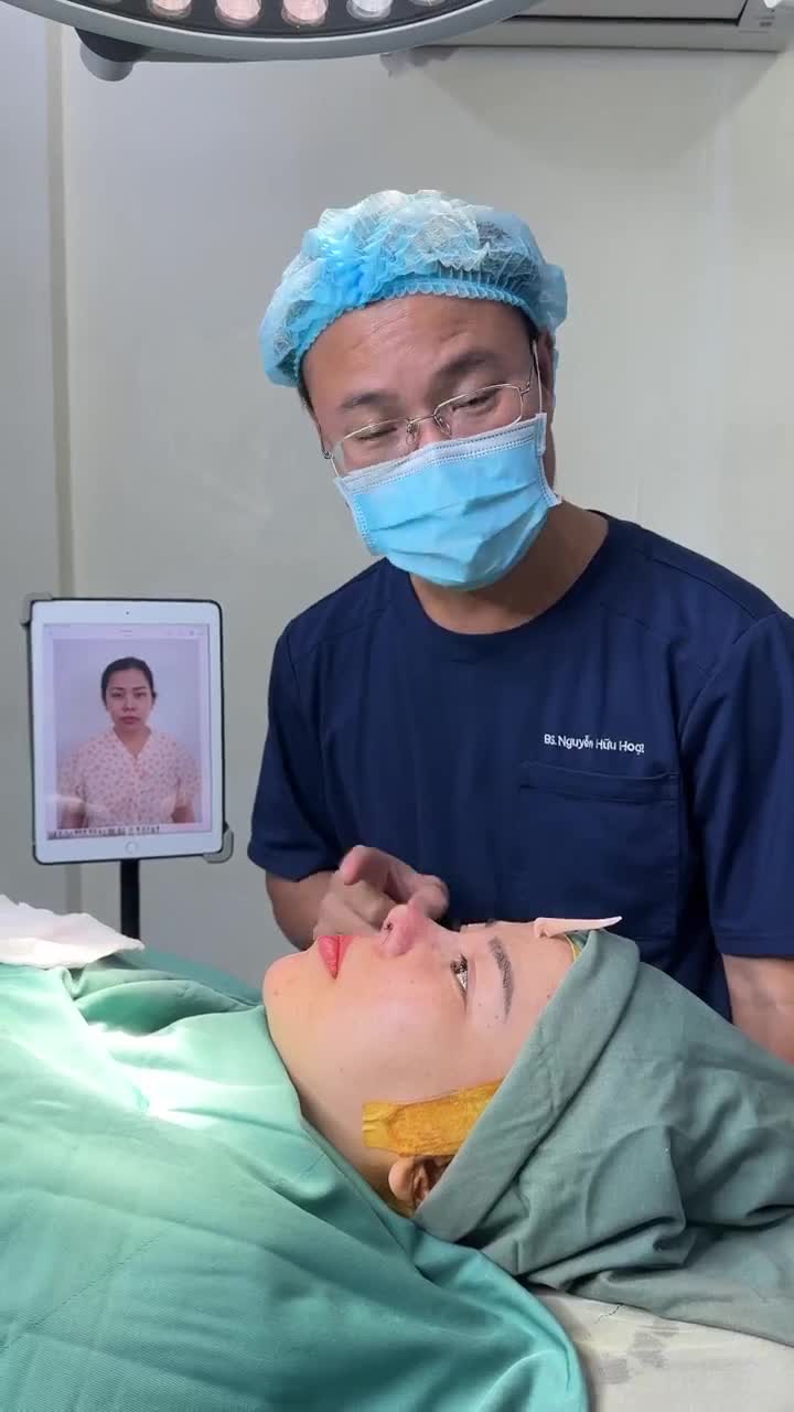 BÁC SĨ HOẠT TRẢ KẾT QUẢ SAU 60 PHÚT SỬA LẠI MŨI HỎNG