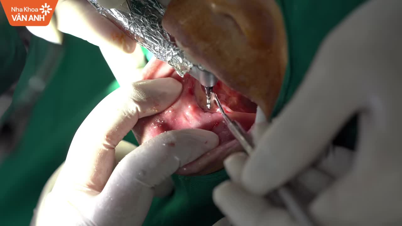 “Kể cả làm xong mẹ sống thêm được một ngày vui vẻ, ăn ngon là sướng rồi!”