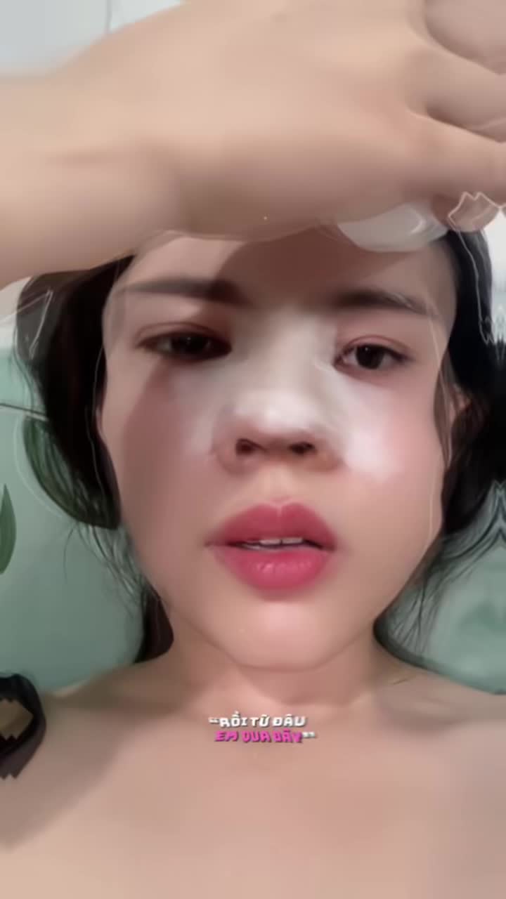 Trước và sau 6 tháng tháo nẹp mũi khác nhau thế nào?