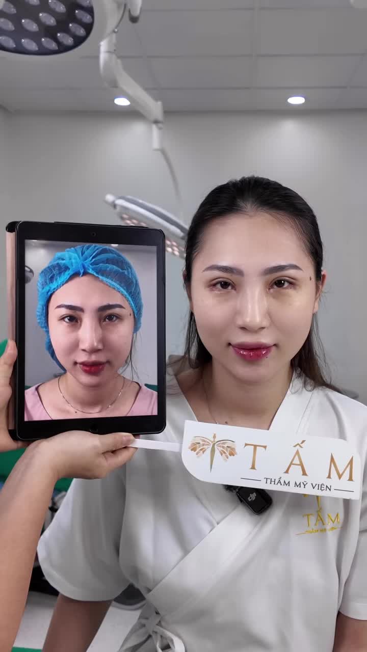 "Ai cũng bảo chị như thay đầu vậy". Đôi mắt của chị T.A đã thay đổi như thế nào mà lại nhận được nhiều lời khen đến vậy?