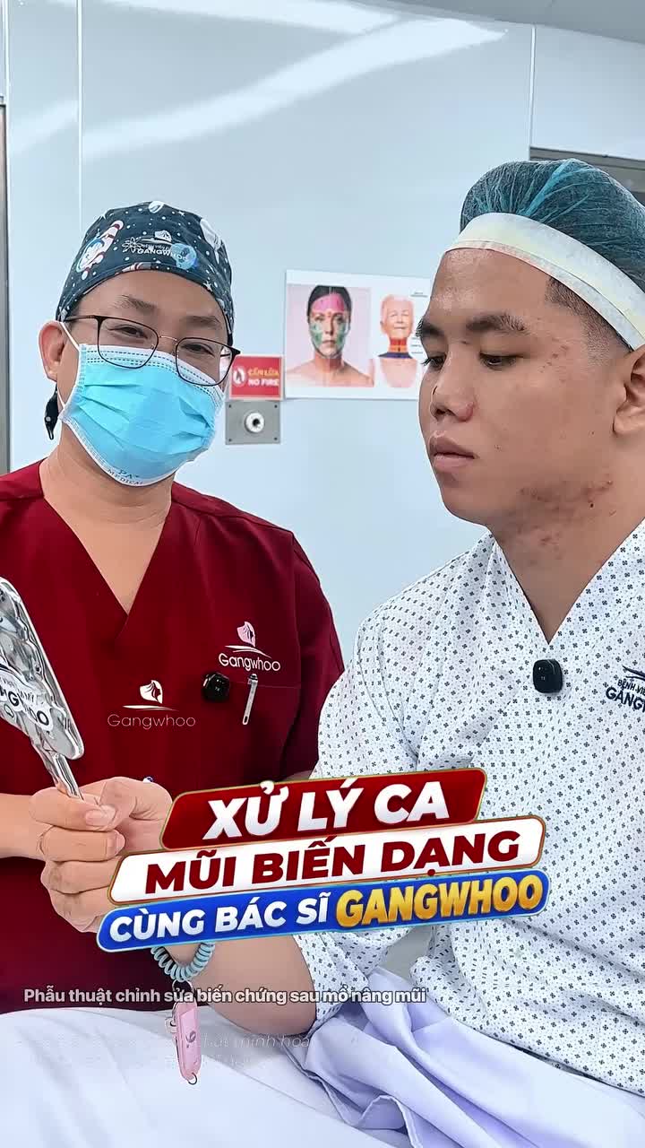 Mũi co rút, khuyết mô vì tai nạn. Cùng xem bác sĩ từng bước xử lý ca khó này như thế nào?