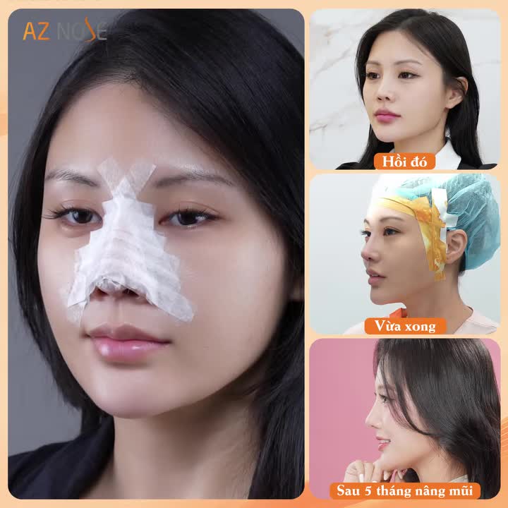 Một dáng mũi mềm mại đôi khi cũng làm visual “hack tuổi” kha khá