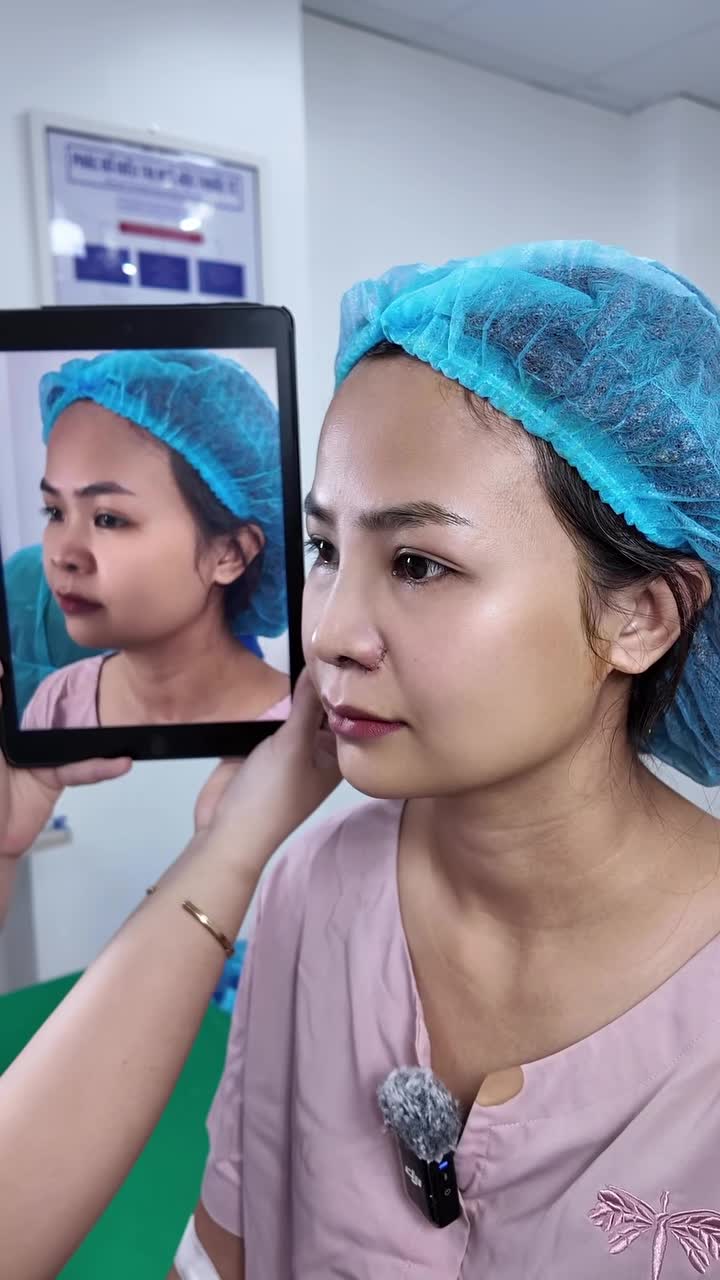 "Không đau tí nào cả" - Chị P.U nhận xét. Với Tấm, một ca mũi thành công có lẽ không chỉ được đánh giá qua chiếc mũi cao bay mềm mại mà còn dựa vào sự hài hòng từ các chị em