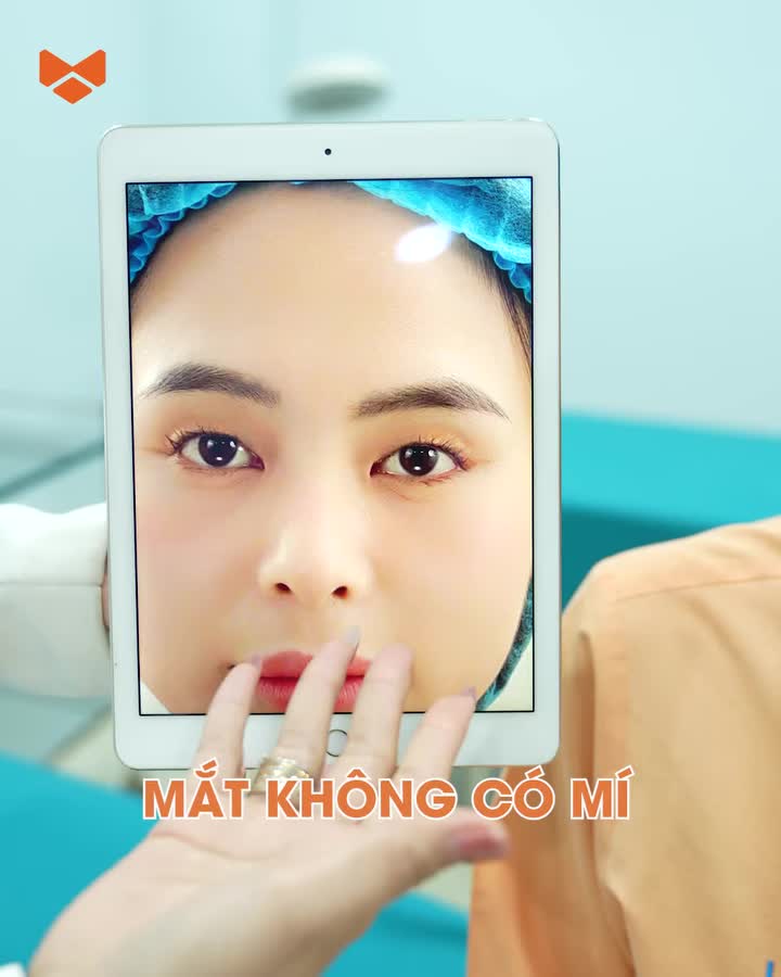 Cắt mí gì chưa mấy người đẹp