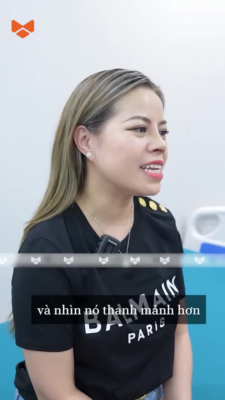 Feedback khách hàng sau 7 ngày nâng mũi không băng nẹp tại Ratio