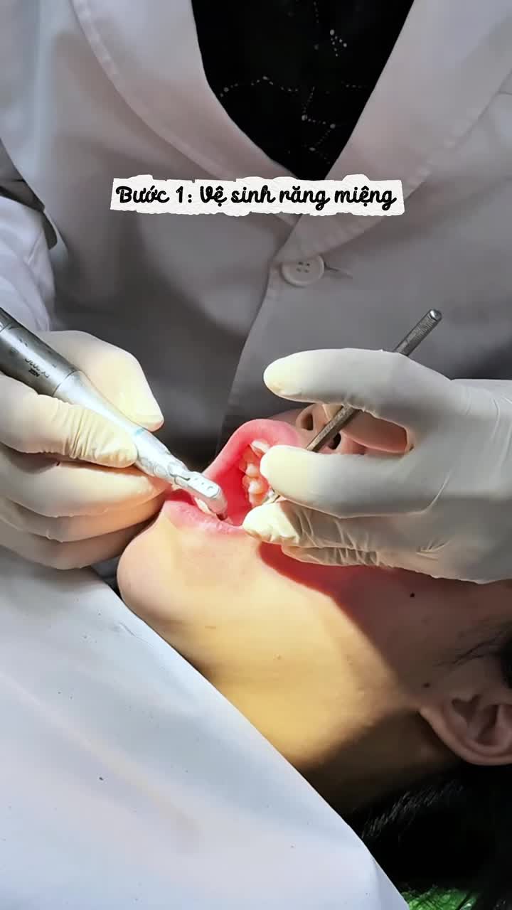 Bắt đầu hành trình nụ cười của Bạn ngay hôm nay cùng bác sĩ Nha Khoa Đăng Lưu - thấu hiểu mong muốn và tìm ra phác đồ niềng răng phù hợp dành cho riêng Bạn!