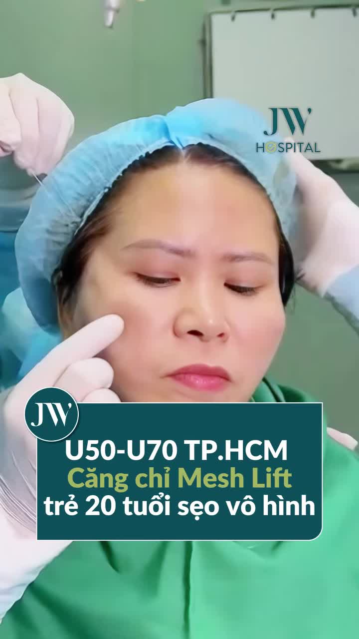 BÁC SĨ TÚ DUNG CĂNG CHỈ MESH LIFT GIÚP 2000+ CHỊ EM U50-U70 TP.HCM TRẺ 20 TUỔI, SẸO VÔ HÌNH