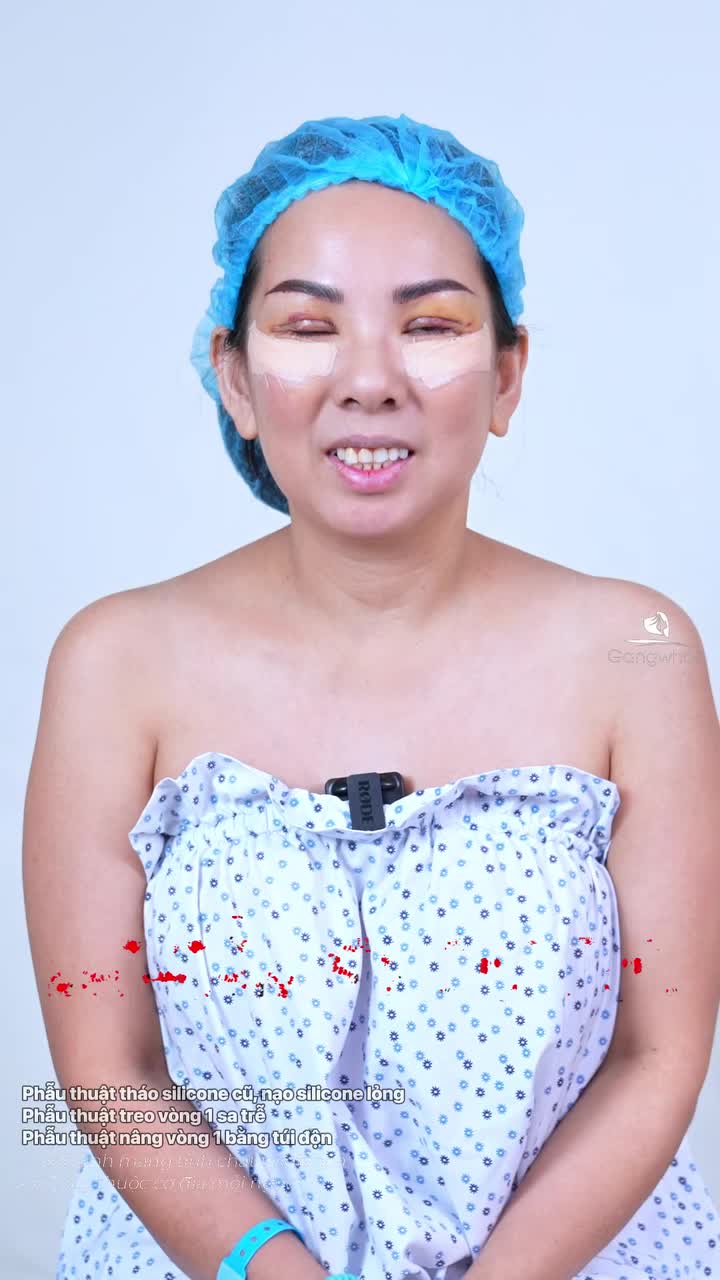 Tác hại khi đặt túi vòng 1 size túi quá to. Khách hàng tìm tới Gangwhoo muốn thay lại size túi vừa vặn, tự nhiên hơn sau nhiều năm đặt túi