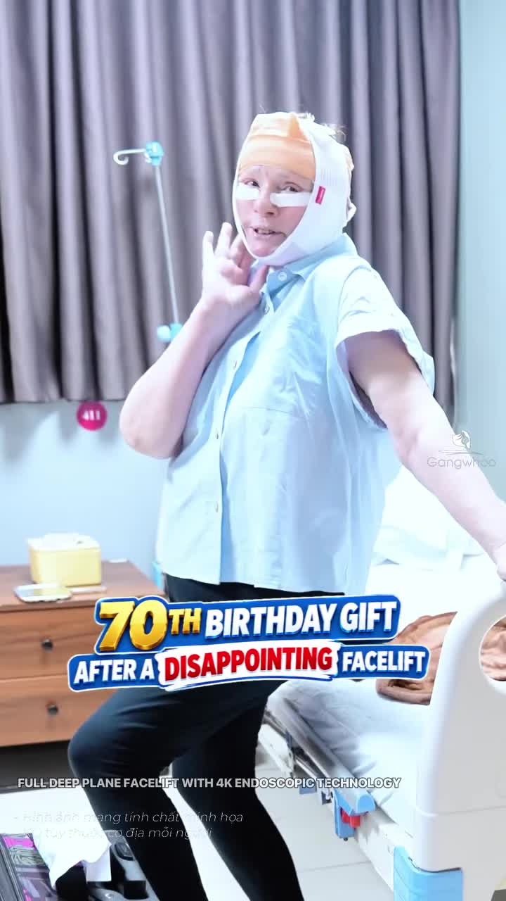 A Birthday Gift to Herself at 70 – Deep Plane Facelift With 4K Endoscopic Technology
