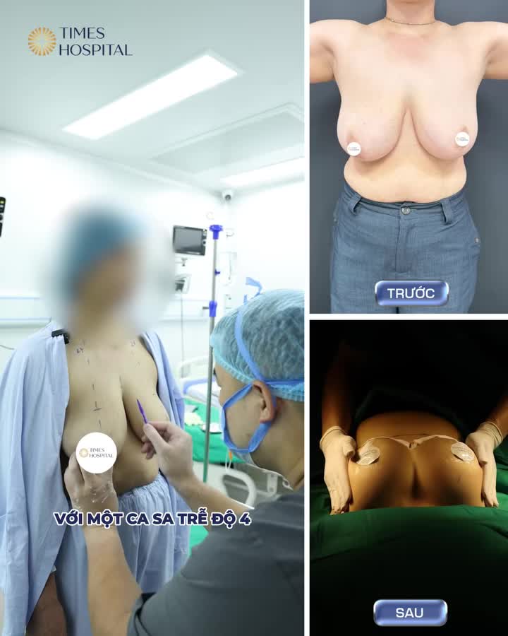 SẸO DỌC, SẸO NGANG - ĐÂU LÀ PHƯƠNG ÁN TỐI ƯU CHO SA TRỄ NẶNG?