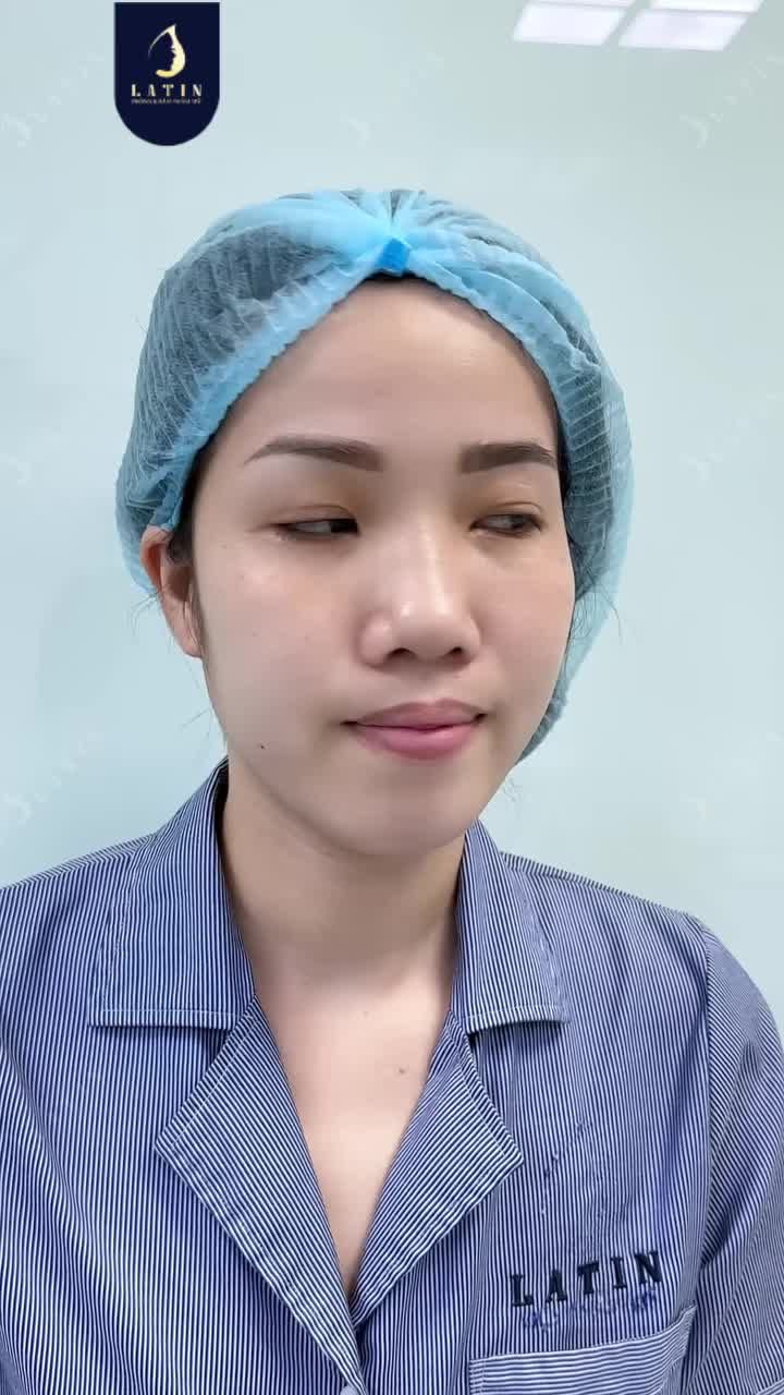 GẶP LẠI CHÍNH MÌNH TRONG PHIÊN BẢN HOÀN HẢO HƠN SAU NÂNG MŨI CẤU TRÚC