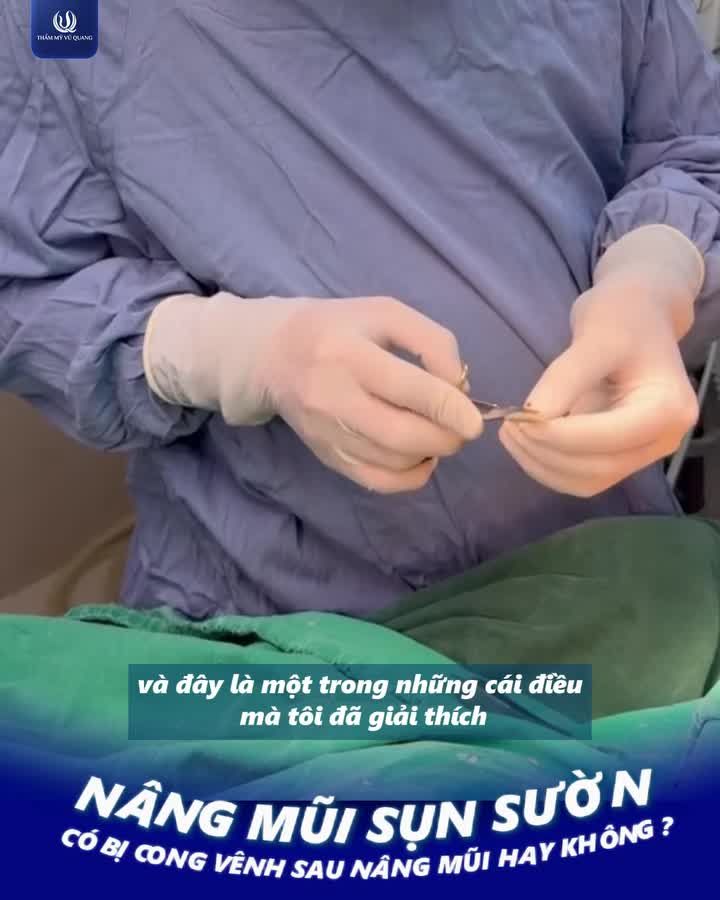 Nâng mũi sụn sườn có bị CONG VÊNH theo thời gian?