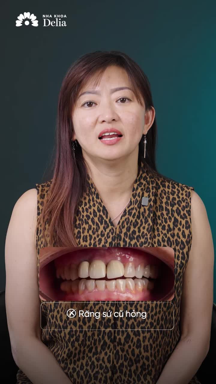 GIẢI CỨU" RĂNG SỨ HỎNG - VÌ SAO HÀNG NGÀN KIỀU BÀO CHỌN DELIA?