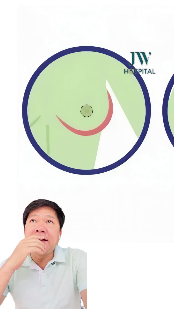 BÁC SĨ TÚ DUNG GIẢI MÃ 5 ĐIỂM CẦN CÂN NHẮC TRƯỚC KHI NÂNG VÒNG 1 ĐƯỜNG NÀY