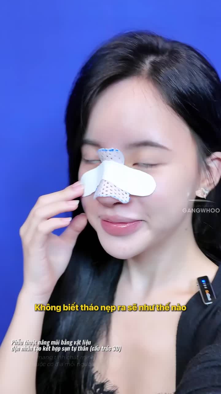 Hồi hộp giây phúc tháo nẹp mũi sau bao nhiều ngày chờ đợi