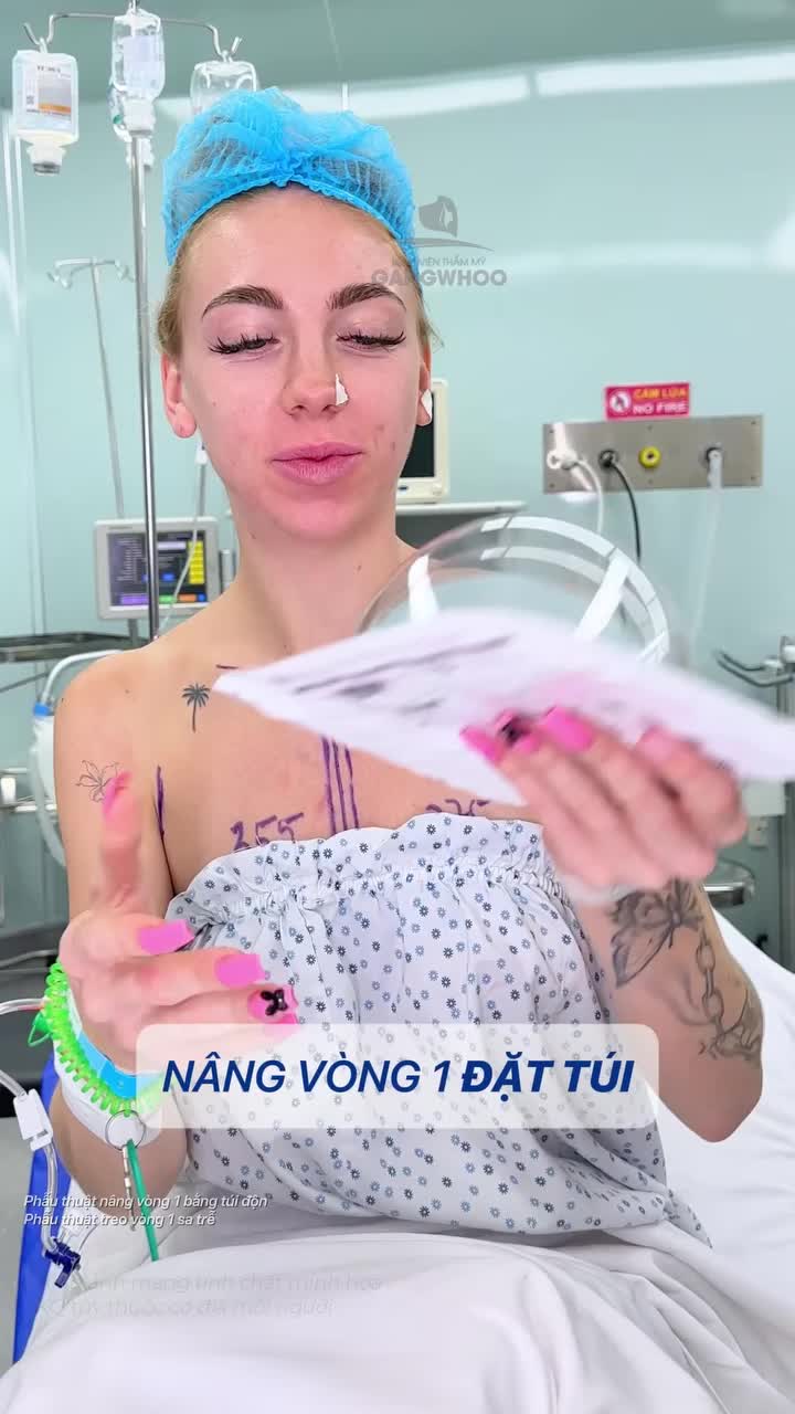 Treo vòng 1 sa trễ  và nâng vòng 1 đặt túi có điểm gì khác biệt