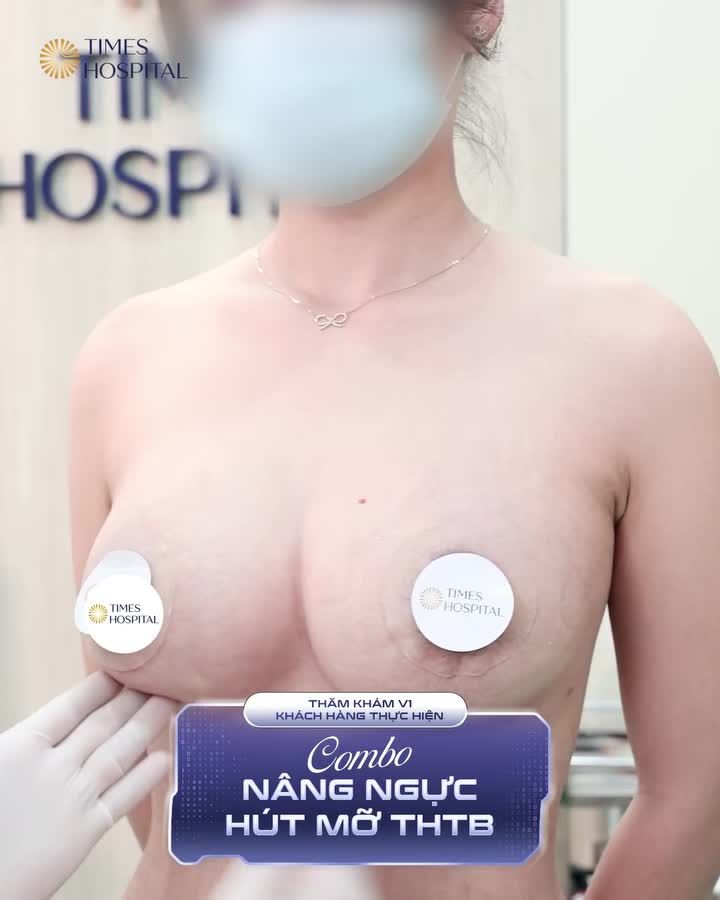 Feedback sau 1 tháng nâng cấp vòng 1 tại Times Hospital